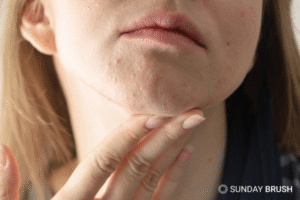 Blogfoto Zonnebrand voor de zeer gevoelige huid - Sunday Brush